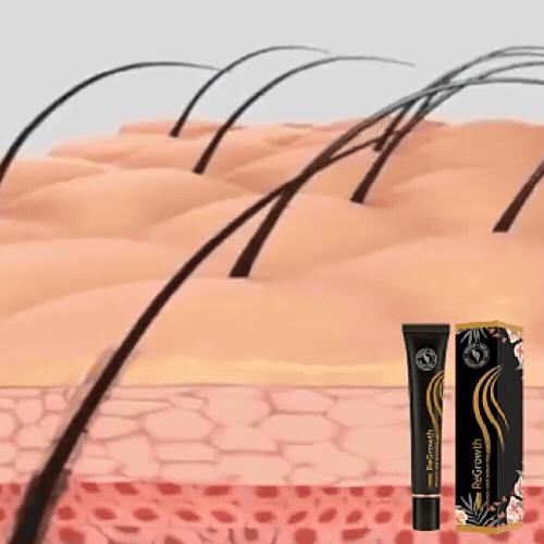 Anti-Hair Loss Serum - Stimulates Growth & Roots