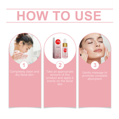 Hoygi Nicotinamide Anti-Acne Serum Mild Anti-Acne Serum Improve Acne Moisturizing Repair Serum