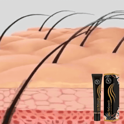 Sérum Anti-Chute Cheveux - Stimule Pousse & Racines